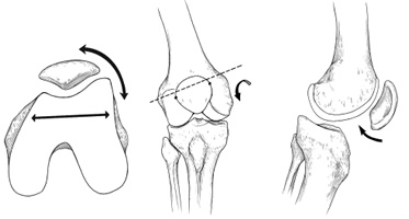 Rodilla anterior: dolor rodilla anterior