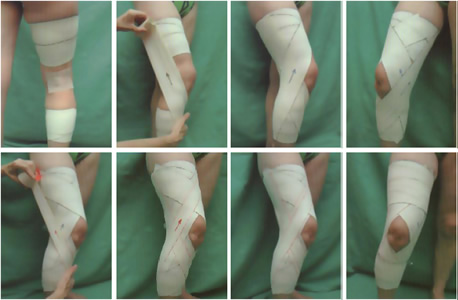 Vendaje rodilla: dolor de rodilla