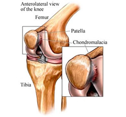 Articulación rodilla