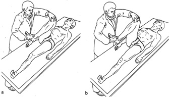 Dolor rodilla causas Dolor rodilla causas