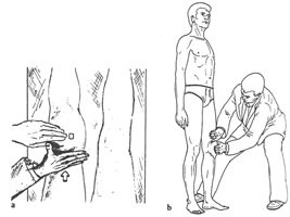 Dolor rodilla causas Dolor rodilla causas