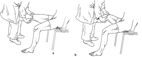Dolor rodilla causas Dolor rodilla causas