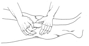 Dolor rodilla causas Dolor rodilla causas