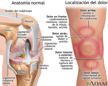 Dolor rodilla: causas del dolor rodilla