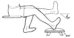 Ejercicios rodilla: Fortalecer rodillas