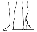 Ejercicios rodilla: Fortalecer rodillas Ejercicios rodilla: Fortalecer rodillas