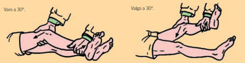 Lesión rodilla: LEsguince rodilla Lesión rodilla: Esguince rodilla