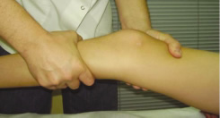 Fisioterapia rodilla: ligamentos cruzados Fisioterapia rodilla: ligamentos cruzados