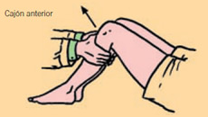 Lesión rodilla: Test de cajón