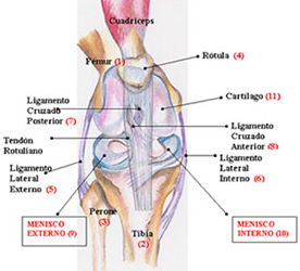 Menisco rodilla: dolor rodilla menisco