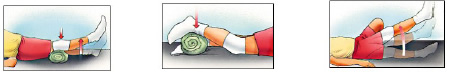 Rehabilitación rodilla Rehabilitación rodilla