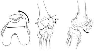 Rodilla anterior: dolor rodilla anterior Rodilla anterior: dolor rodilla anterior