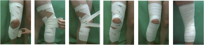 Vendaje rodilla: dolor de rodilla Vendaje rodilla: dolor de rodilla