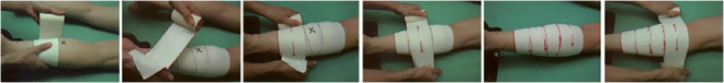 Vendaje rodilla: dolor de rodilla Vendaje rodilla: dolor de rodilla