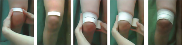 Vendaje rodilla: dolor de rodilla Vendaje rodilla: dolor de rodilla
