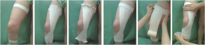 Vendaje rodilla: dolor de rodilla Vendaje rodilla: dolor de rodilla