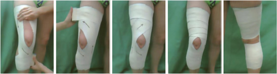 Vendaje rodilla: dolor de rodilla Vendaje rodilla: dolor de rodilla