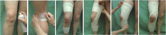 Vendaje rodilla: dolor de rodilla Vendaje rodilla: dolor de rodilla