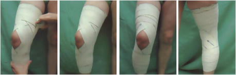 Vendaje rodilla: dolor de rodilla Vendaje rodilla: dolor de rodilla