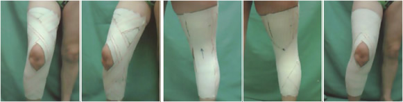 Vendaje rodilla: dolor de rodilla Vendaje rodilla: dolor de rodilla