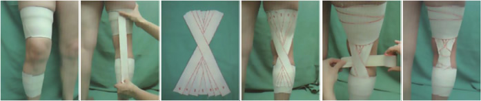 Vendaje rodilla: dolor de rodilla Vendaje rodilla: dolor de rodilla