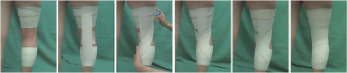 Vendaje rodilla: dolor de rodilla